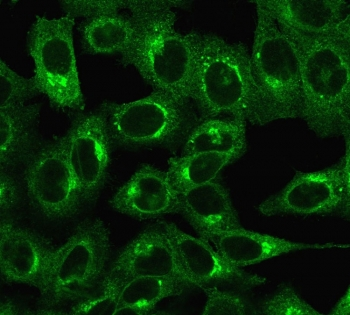 Beta-2 Microglobulin Antibody