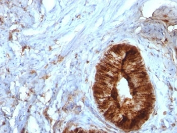 Beta-2 Microglobulin Antibody