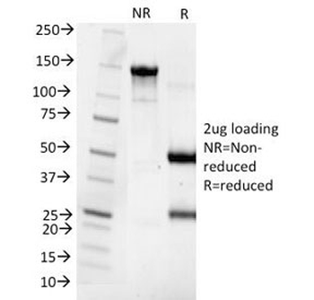 Parathyroid Hormone Antibody / N Terminal