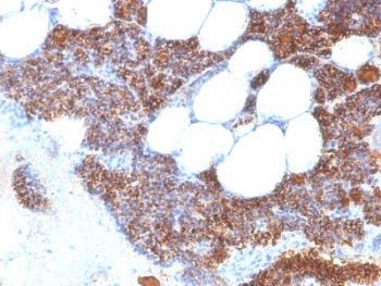 Parathyroid Hormone Antibody / N Terminal