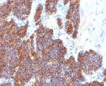 Parathyroid Hormone Antibody / C Terminal