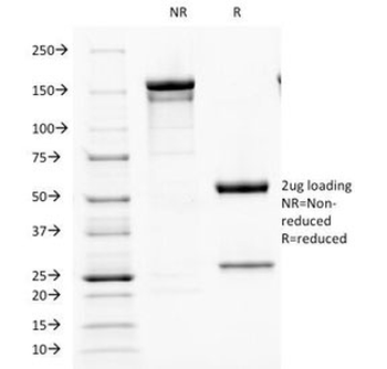 Parathyroid Hormone Antibody / C Terminal