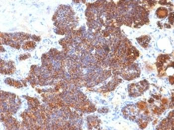 Parathyroid Hormone Antibody / C Terminal