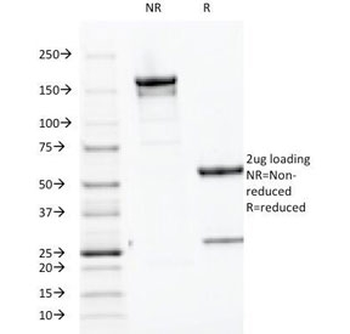 Parathyroid Hormone Antibody / C Terminal