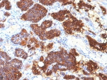 Parathyroid Hormone Antibody / C Terminal