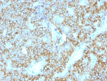 Parathyroid Hormone Antibody / C Terminal