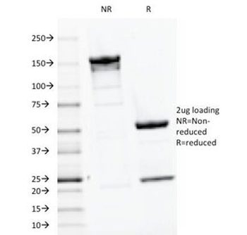 Parathyroid Hormone Antibody / C Terminal