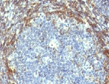 Bcl-2 Antibody