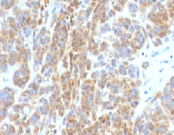 Bcl-2 Antibody