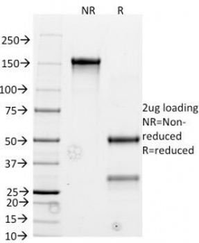 Bcl-2 Antibody