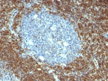 Bcl-2 Antibody