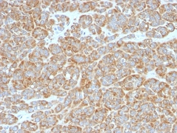 Bcl-2 Antibody