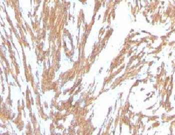 Alpha Actin Antibody / ACTA2 (smooth muscle)