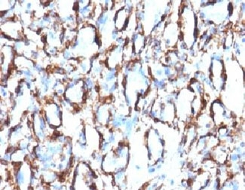 Alpha Actin Antibody / ACTA2 (smooth muscle)
