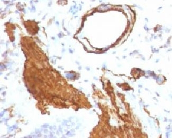 Alpha Actin Antibody / ACTA2 (smooth muscle)