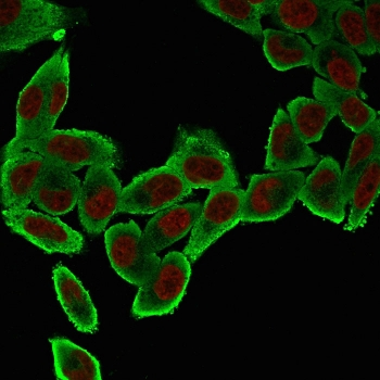Alpha Actin Antibody / ACTA2 (smooth muscle)