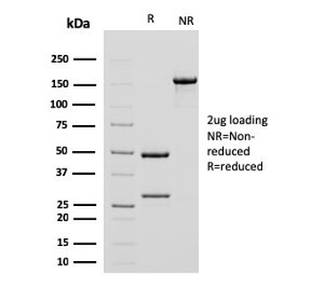 Alpha Actin Antibody / ACTA2 (smooth muscle)