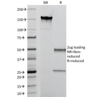 MRP14 Antibody / S100A9