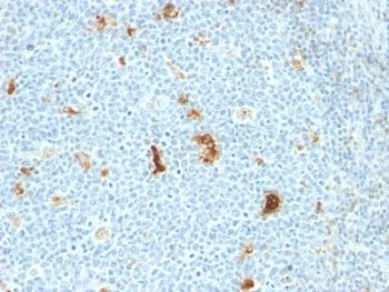 Macrophage Antibody / S100A8 + S100A9 / Calprotectin