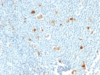 Calprotectin Antibody / L1H subunit