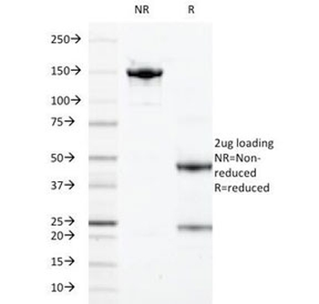 S100A9 Antibody / MRP14 / Calgranulin B / Calprotectin L1H
