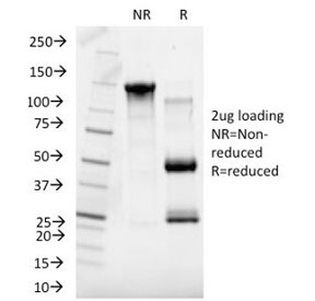 SHBG Antibody (Sex Hormone Binding Globulin)