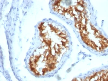 Fascin Antibody