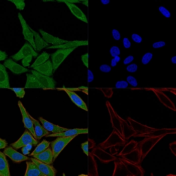 Fascin Antibody