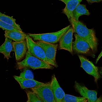 Fascin Antibody