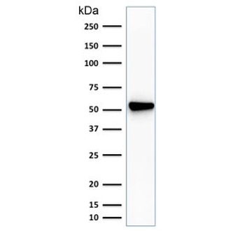 Fascin Antibody
