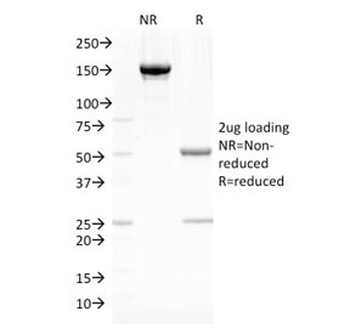 Fascin Antibody
