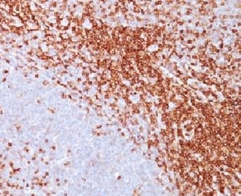 CD43 Antibody
