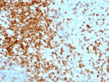CD43 Antibody