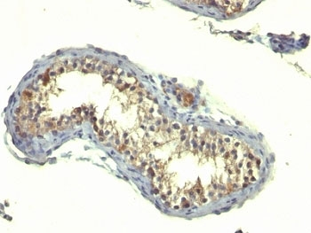 TGF alpha Antibody