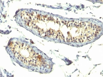 TGF alpha Antibody Cocktail