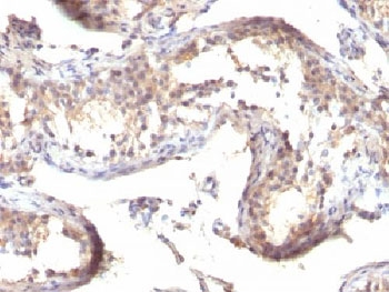 TGF alpha Antibody