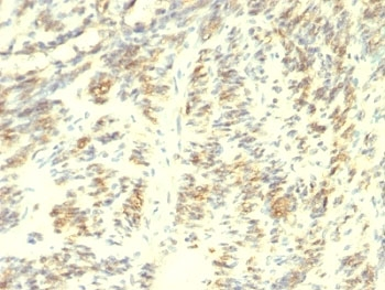 Transglutaminase 2 Antibody