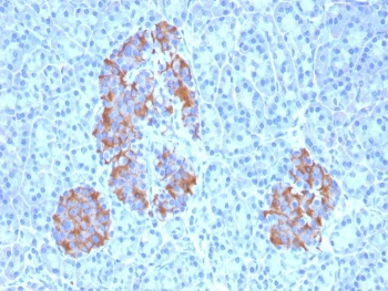 TNF alpha Antibody