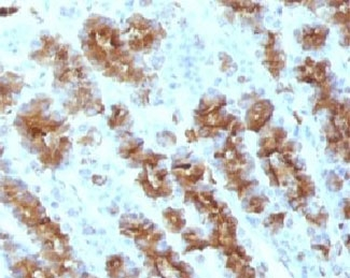 TNF alpha Antibody