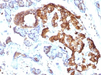 TNF alpha Antibody