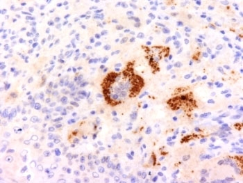 TNF alpha Antibody