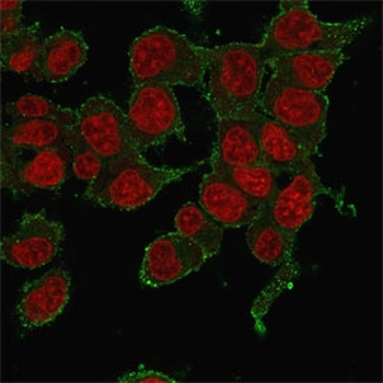 TNF alpha Antibody
