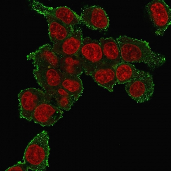 TNF alpha Antibody