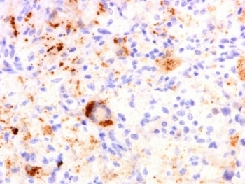 TNF alpha Antibody