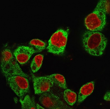 GRP94 Antibody / HSP90B1