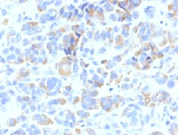 TYRP1 Antibody / TRP1 / Tyrosinase-Related Protein-1 Antibody