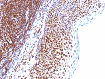 SUMO1 Antibody