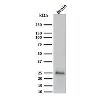 PGP9.5 / UchL1 Antibody