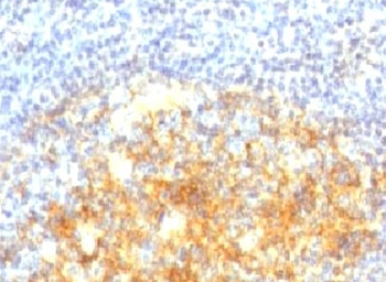 VCAM-1 Antibody