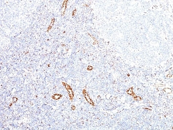 VEGFA Antibody / Vascular Endothelial Growth Factor A